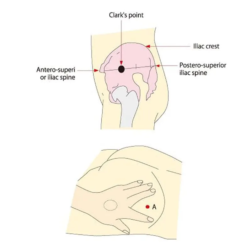 Koken Gluteal Intramuscular Injection Model II
